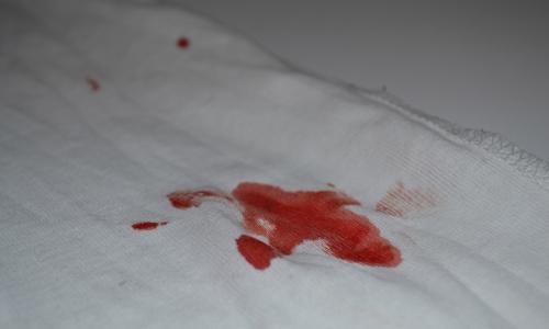 Jak odstranit krev z oblečení 